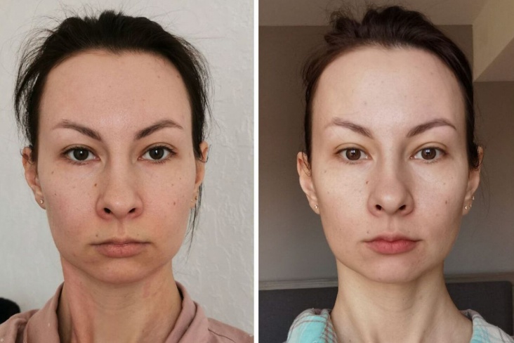 Как изменилось моё лицо после месяца массажа